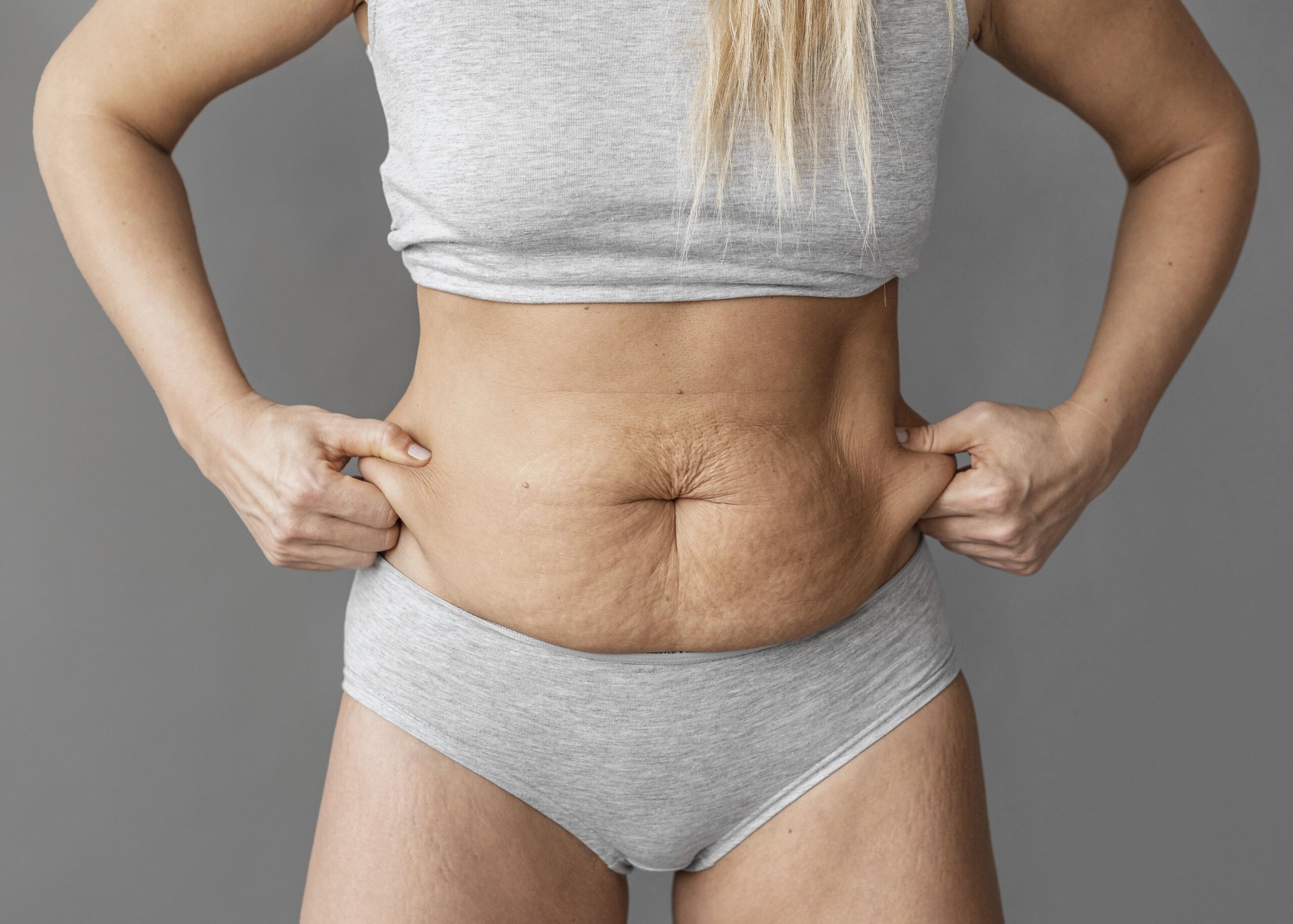 Abdominoplastyka scaled